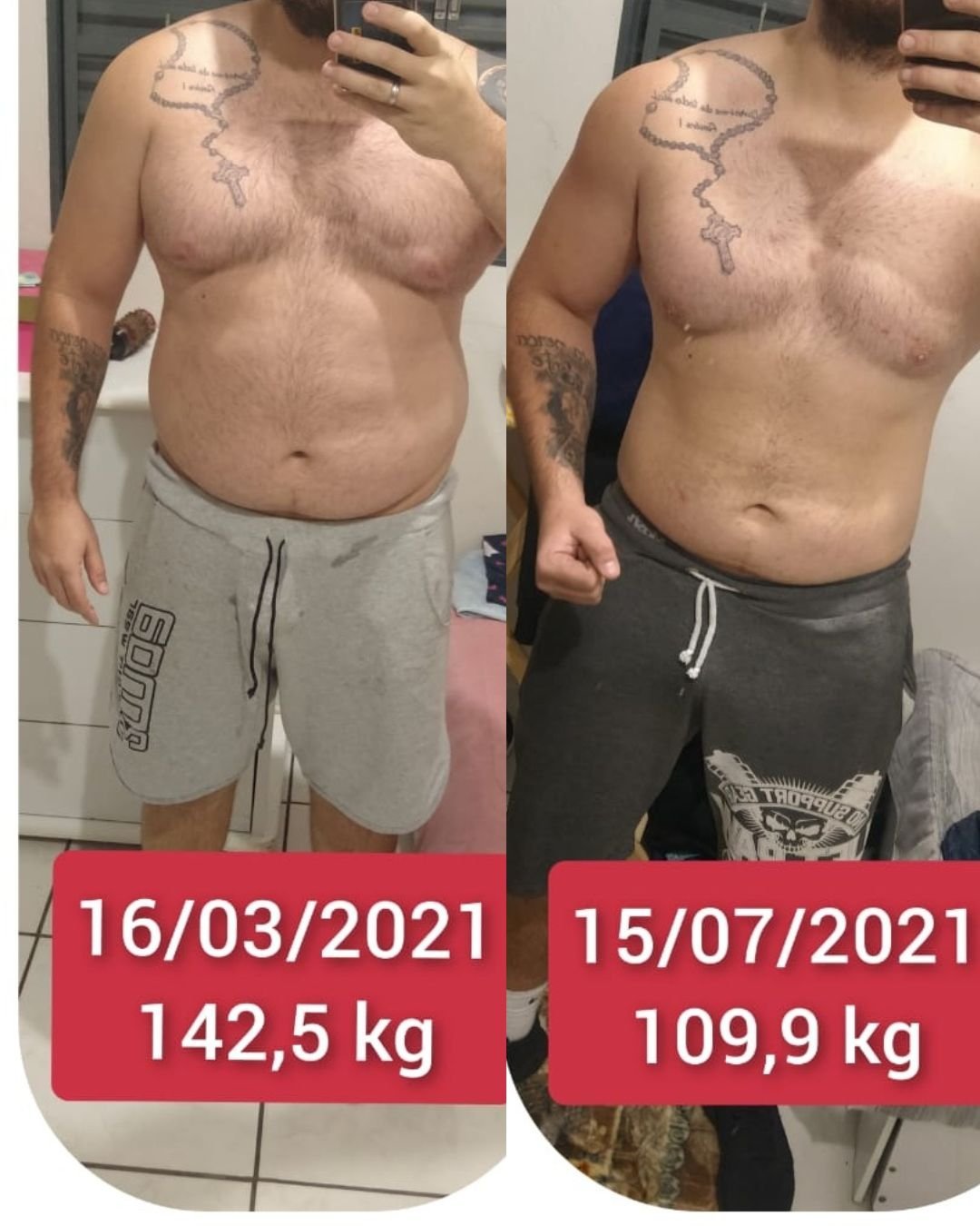 Resultado real de um paciente do Método SFT, antes e depois